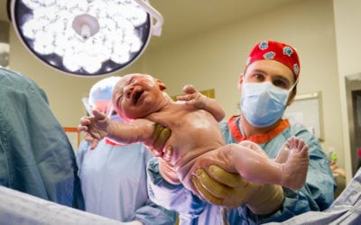 What to Know About C-Section Recovery