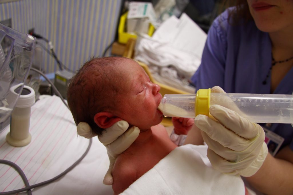 Breastfeeding Your Premature Baby with a Nipple Shield