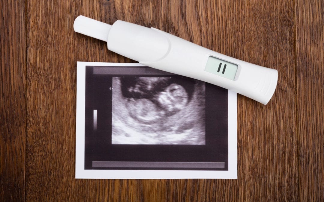 Pregnancy Checklist test and sonogram.