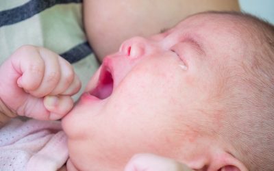 Breastfeeding a Baby with Allergies